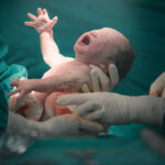 Newborn baby being held by medical staff immediately after birth