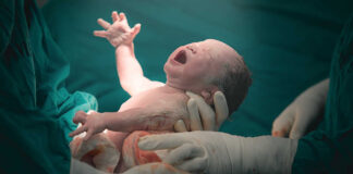 Newborn baby being held by medical staff immediately after birth