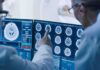 Doctors reviewing brain MRI scans on multiple monitors